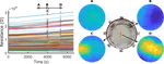 Tactile Perception in Hydrogel-based Robotic Skins using Data-Driven Electrical Impedance Tomography